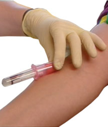 Система Venosafe для вакуумного забора крови (пр-ва Terumo Europe N.V., Бельгия)